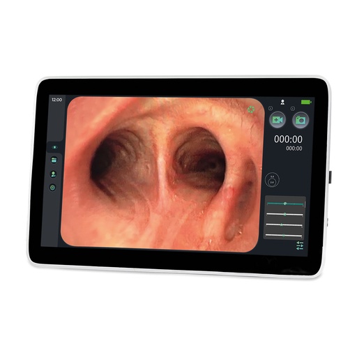 [307000] EickView SD Moniteur d'endoscopie écran tactile 15,6"